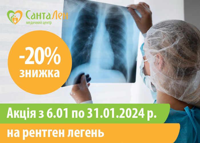 Знижка 20% на рентген легень до 31.01.2024 р.
